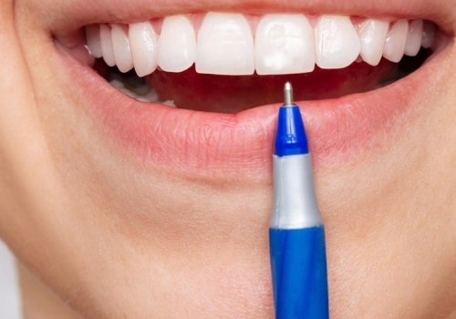 Are teeth whitening pens enamel safe?
