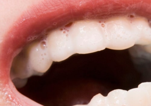 How teeth whitening with baking soda?