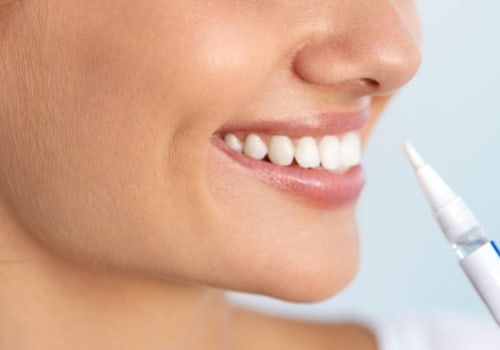 Which tooth whitening is best?