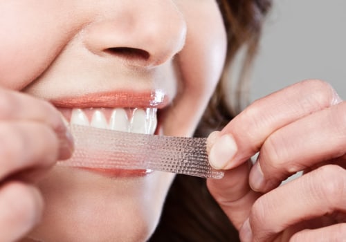 Can teeth whitening strips damage?